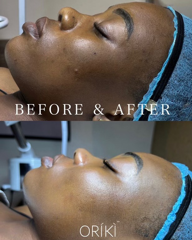 ORIKI Spa Port Harcourt